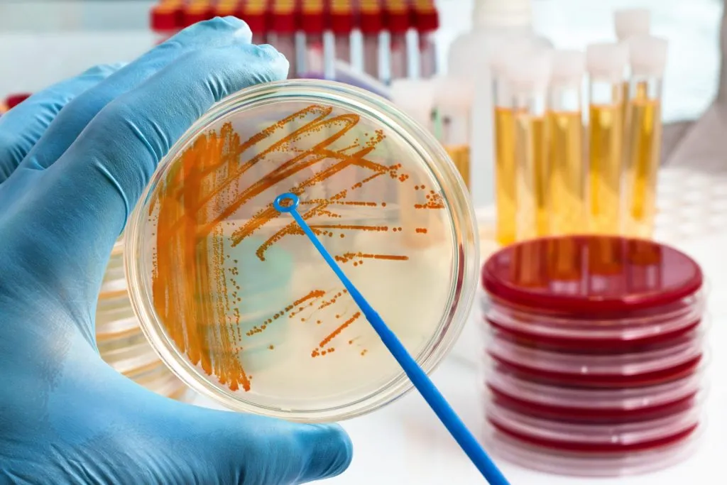 AdobeStock_152781745-microbiology-testing-image-scaled-2-1024x683